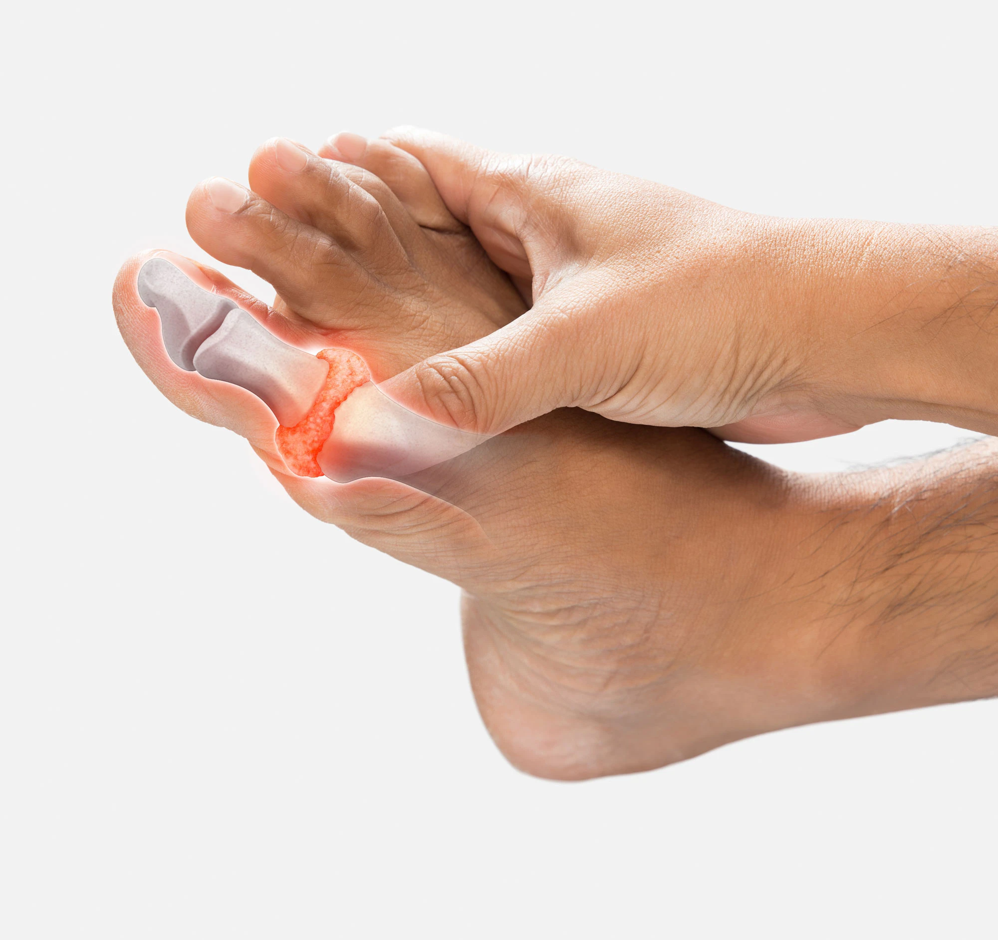 Person rubbing foot