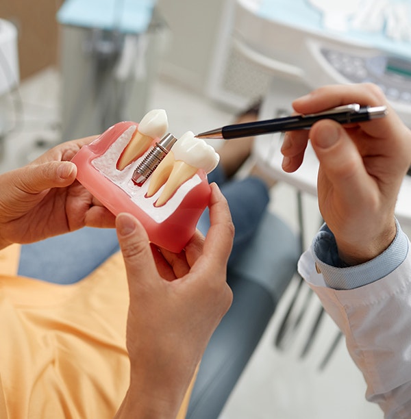 Model of a dental implant