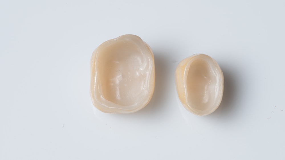 dental crowns