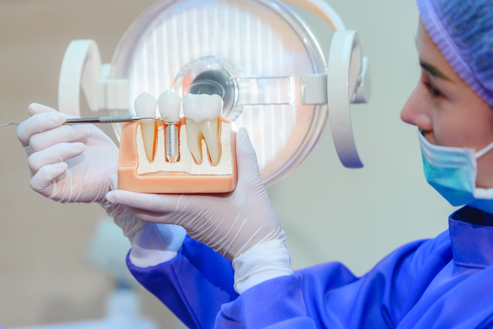 dentist pointing at implant model