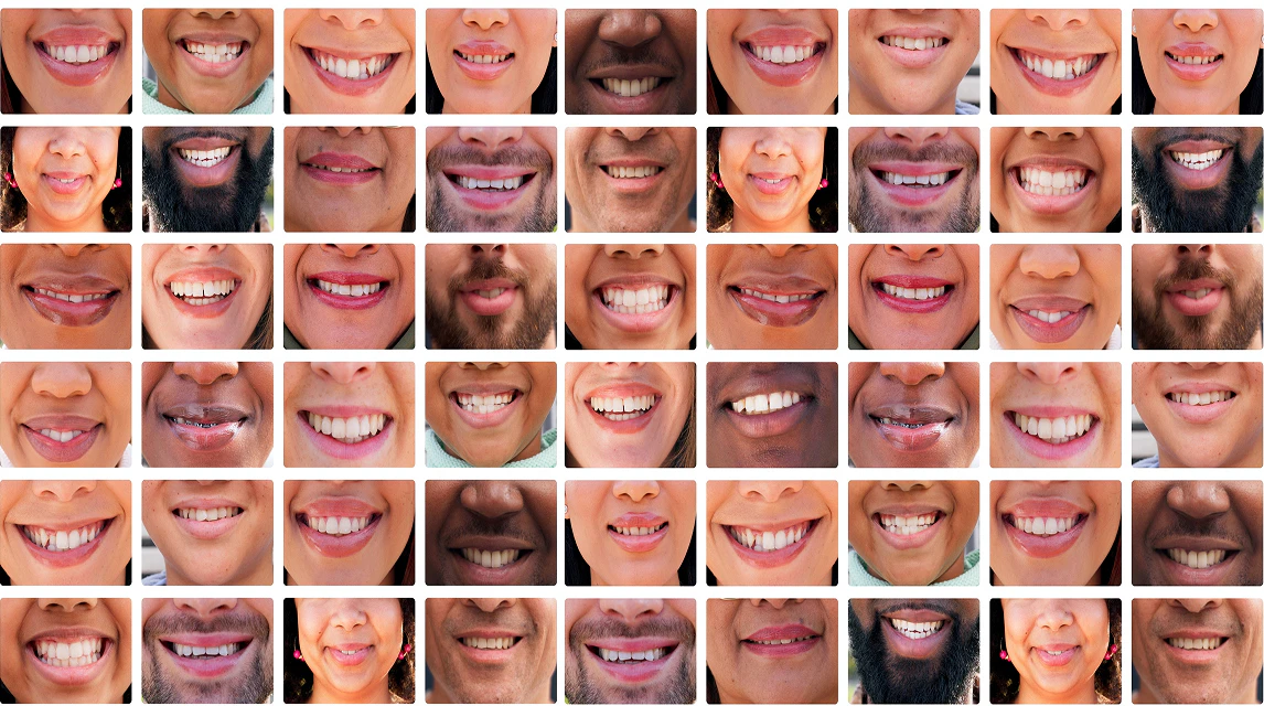 collage of smiling dental patients