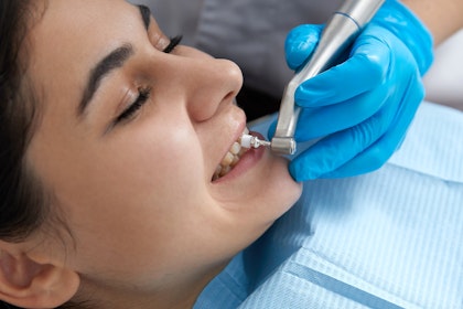 Patient receiving a dental polish