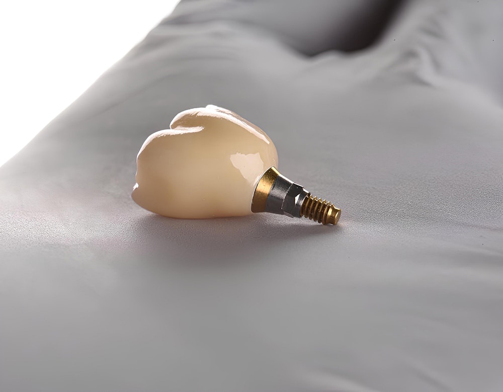 Implant-supported crown