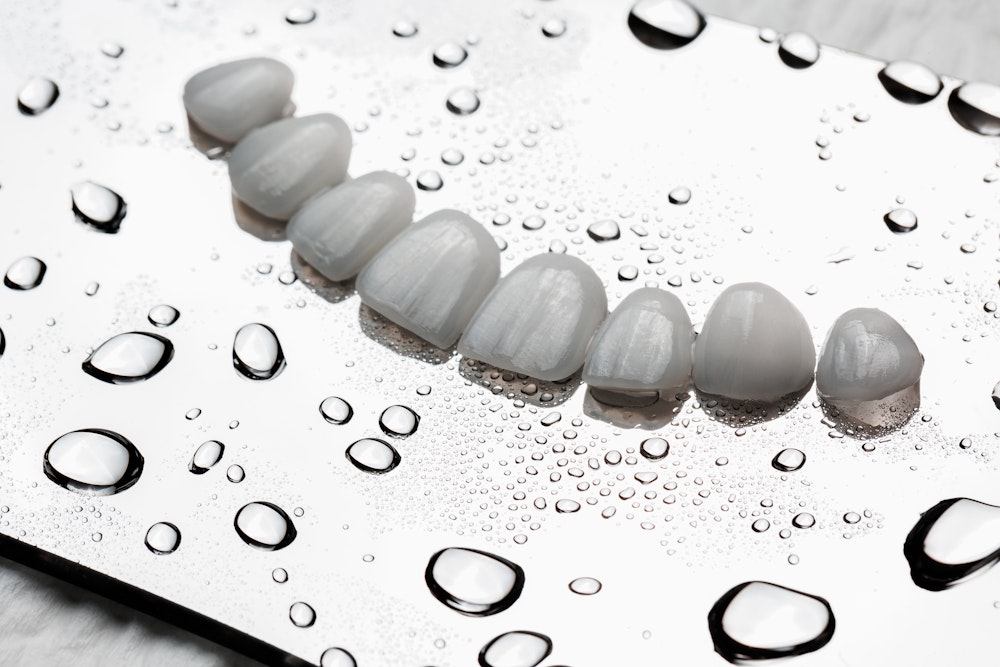 Row of porcelain dental veneers arranged on a reflective surface with water droplets, highlighting texture and translucency.