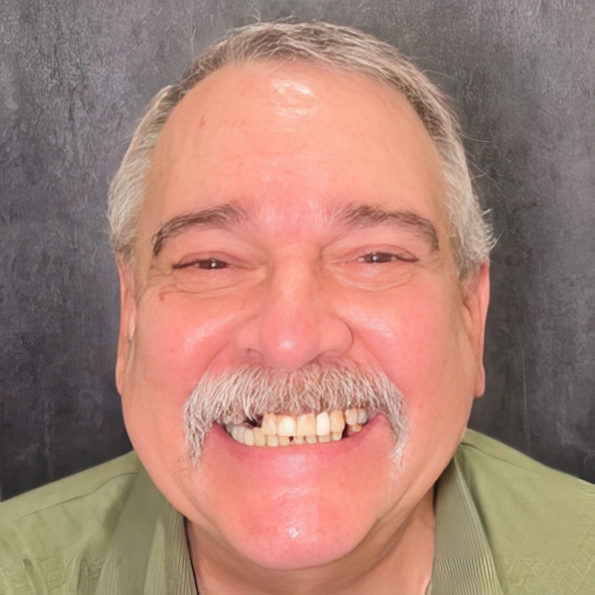 Patient with multiple missing teeth