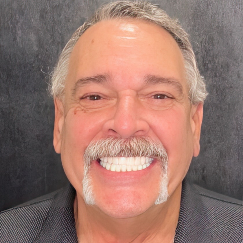 Patient after dental implants treatment