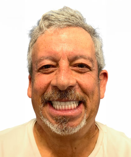 Dr. Khodabakhsh's patient after full mouth reconstruction