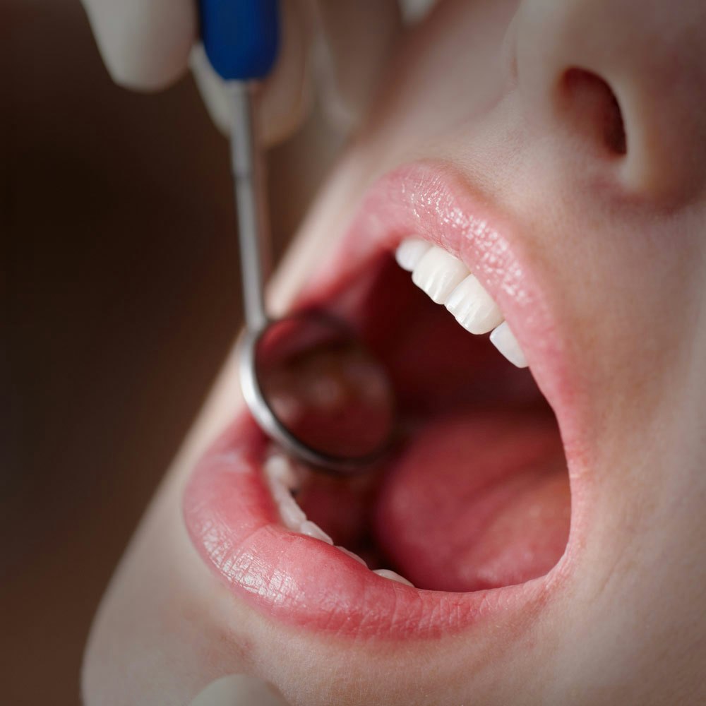 Dentist patient checking for oral pathology