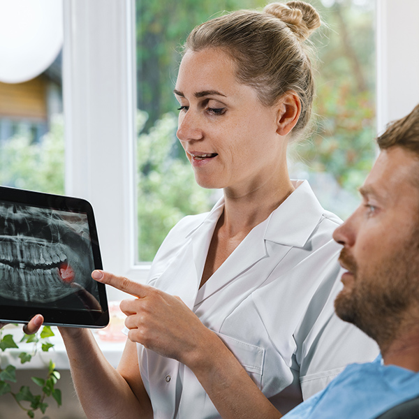 impacted wisdom tooth