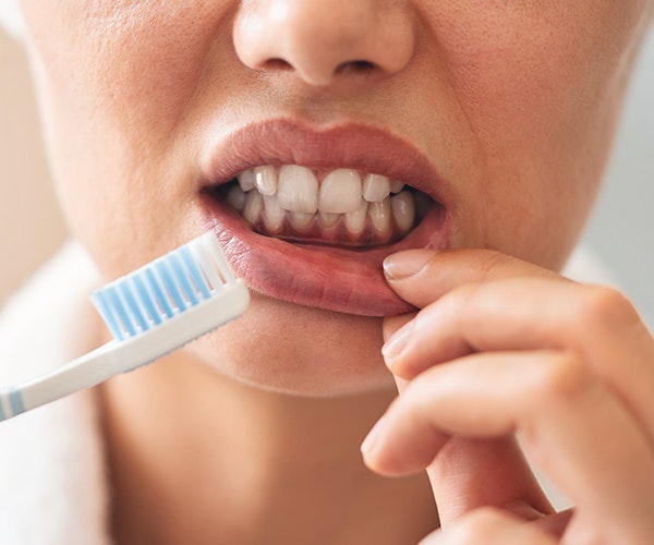 unhealthy gum tissue