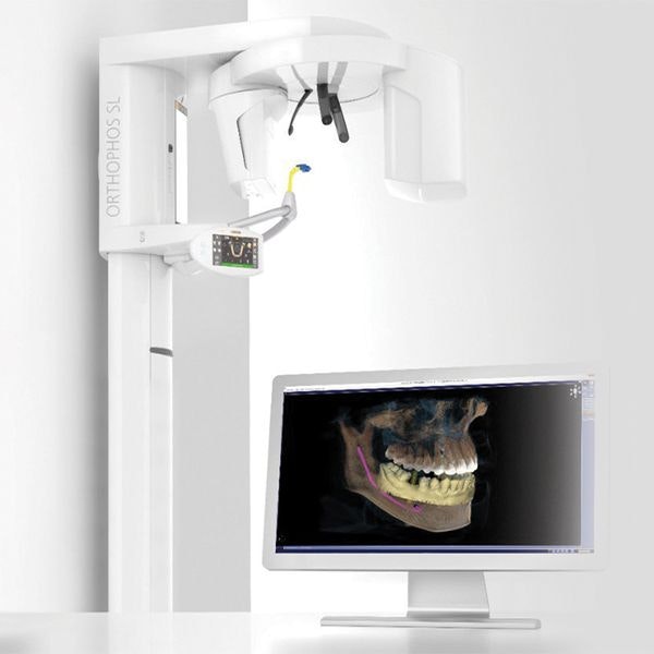 3-D Cone-Beam Scanner