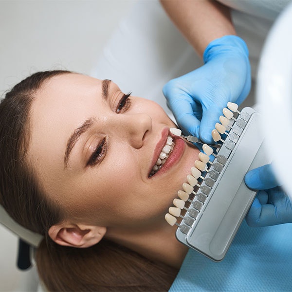 Dentist shade matching for veneers