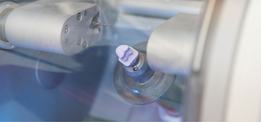 CEREC machine crafting a crown