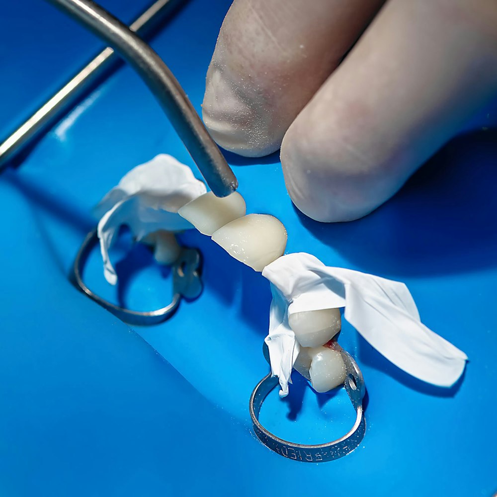 dentist holding dental mold