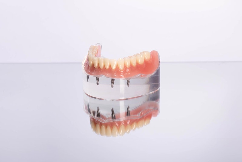 an All-on-4 implant denture