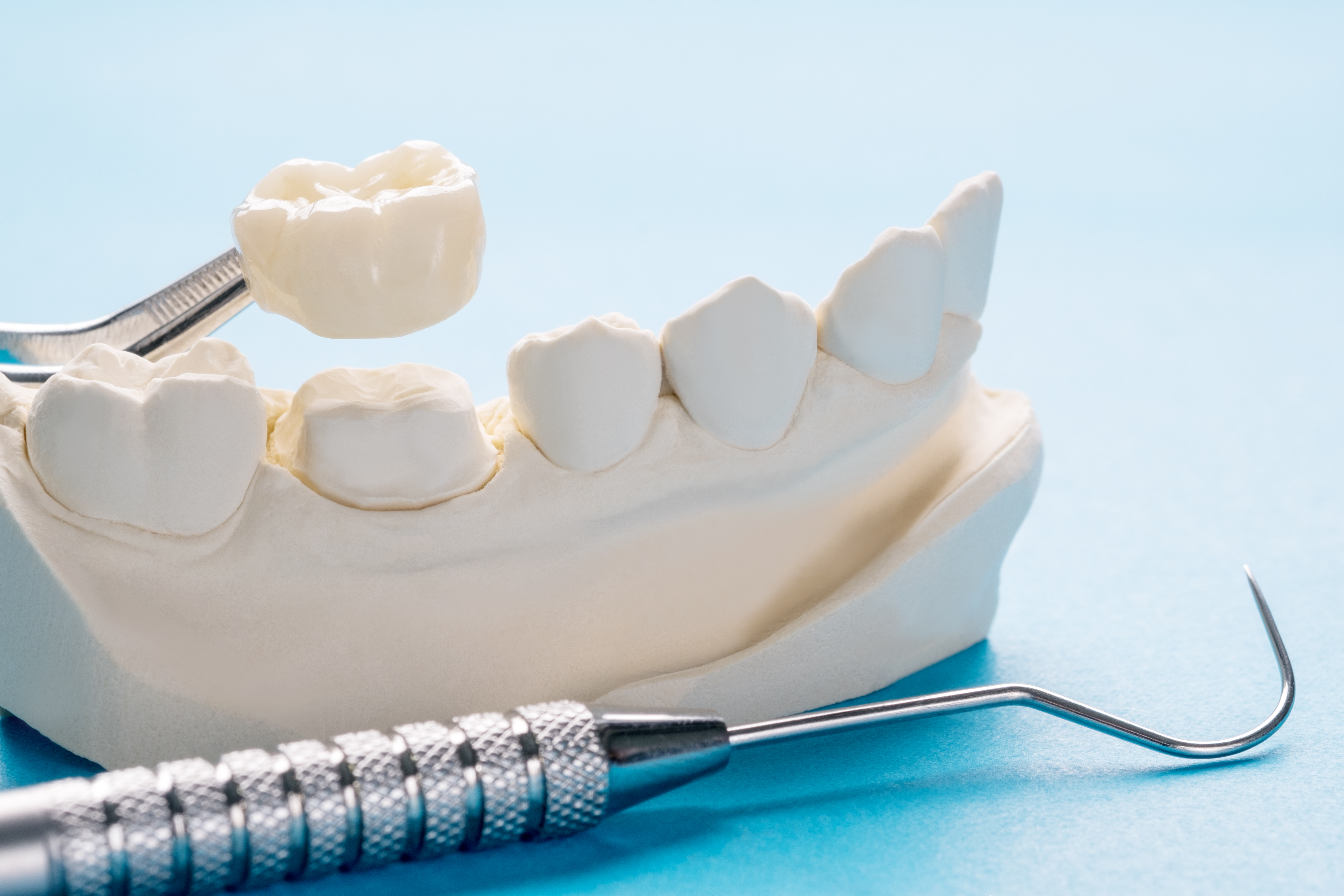 dental crown model