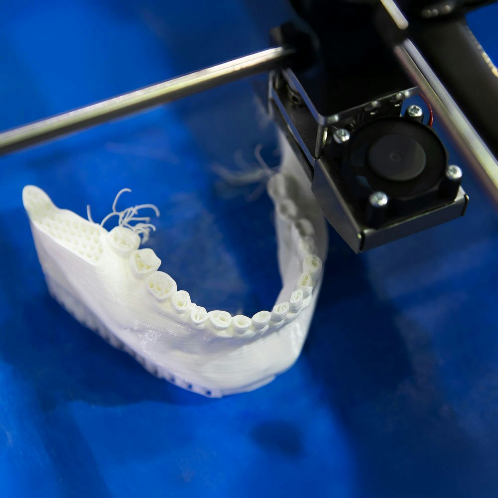 model of dental arch