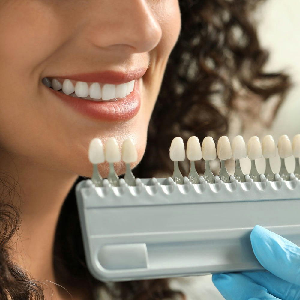 woman choosing a veneer shade