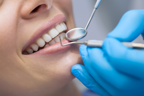 A patient's mouth with dental tools about to explore her teeth