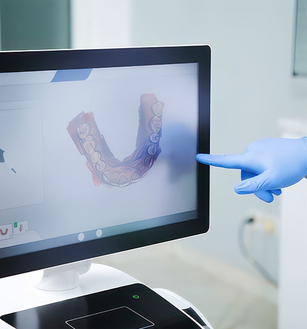 a patient's dental arch on a monitor