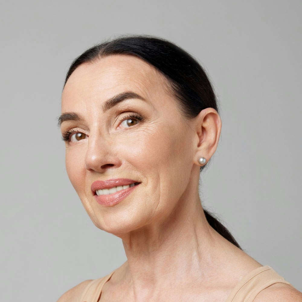 Smiling woman with brow lift