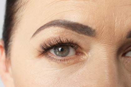 Close up of mature woman's eyebrow after a brow lift