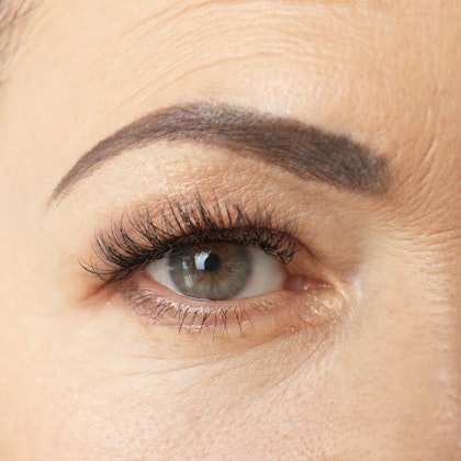 Close up of mature woman's eyebrow after a brow lift