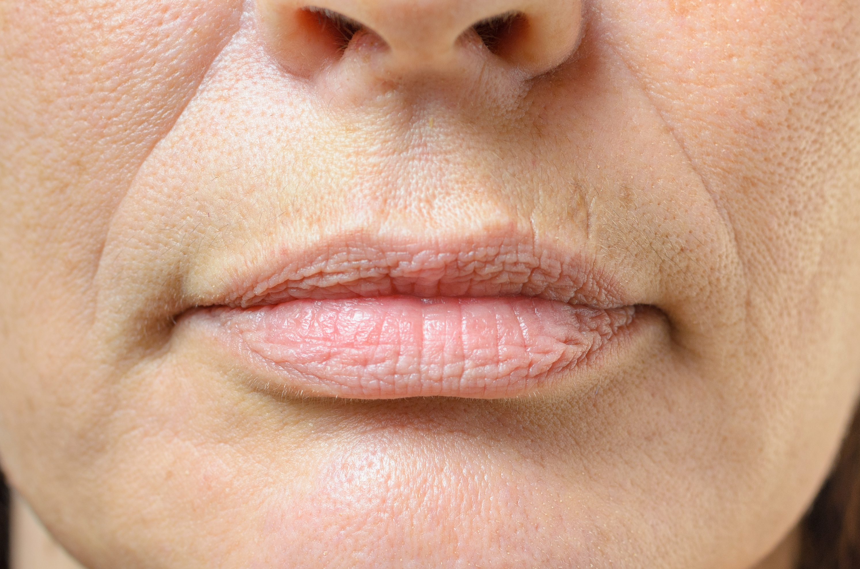 Close-up of lip lines