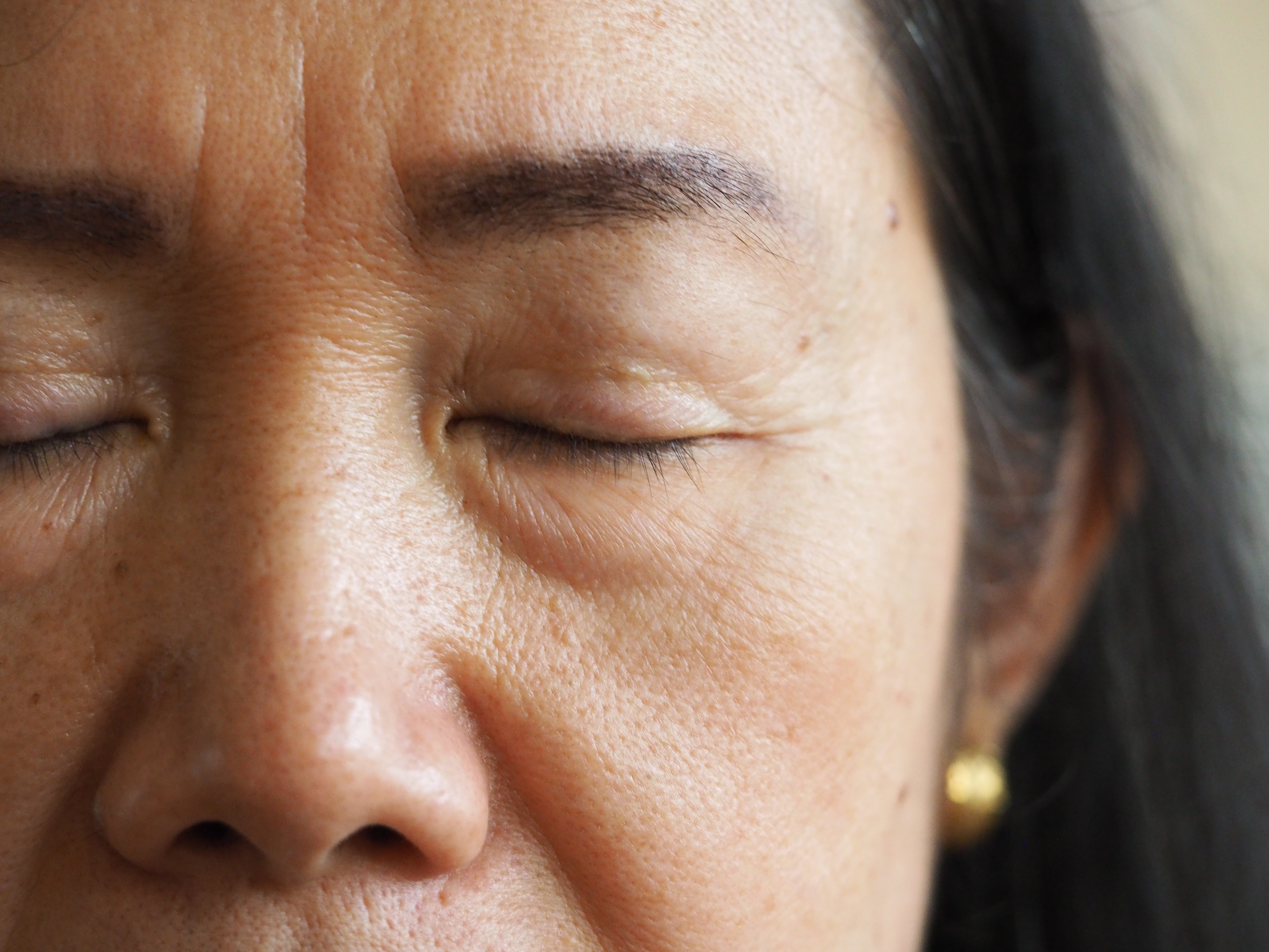 Close-up of frown lines