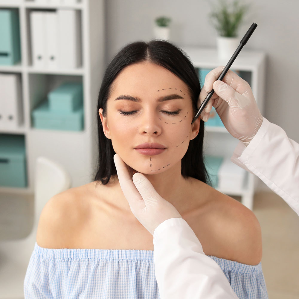Woman being marked up for facial plastic surgery