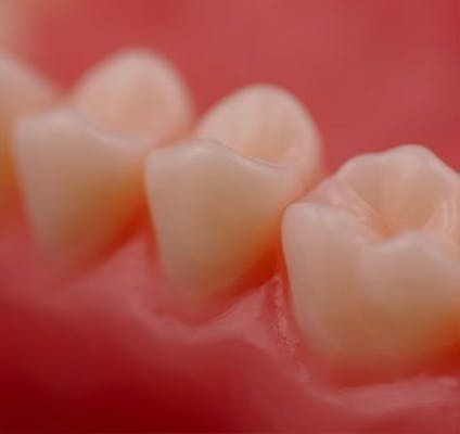 image of tooth