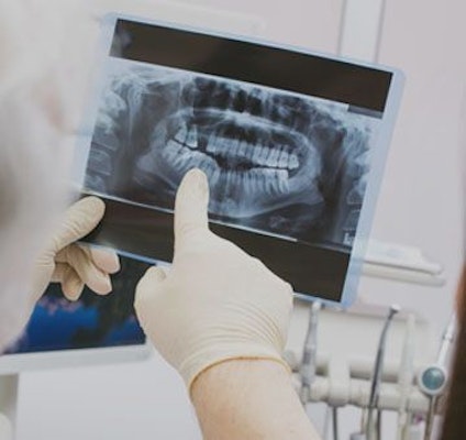 x-ray of a mouth