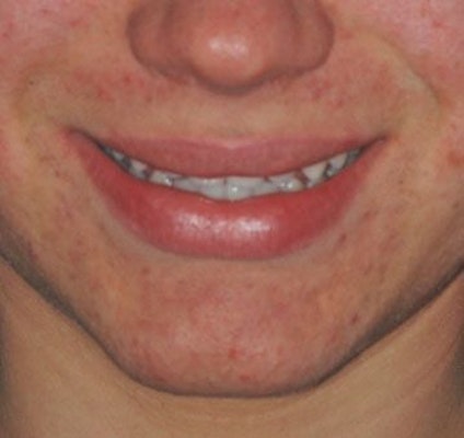 smile that doesn't show teeth