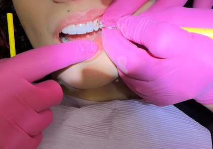 Close-up of a patient receiving dental care
