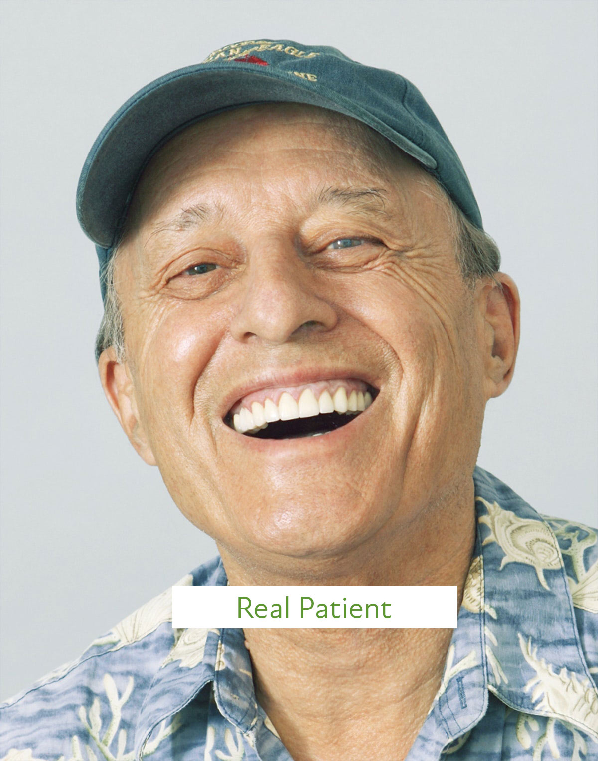 patient after crowns restoration