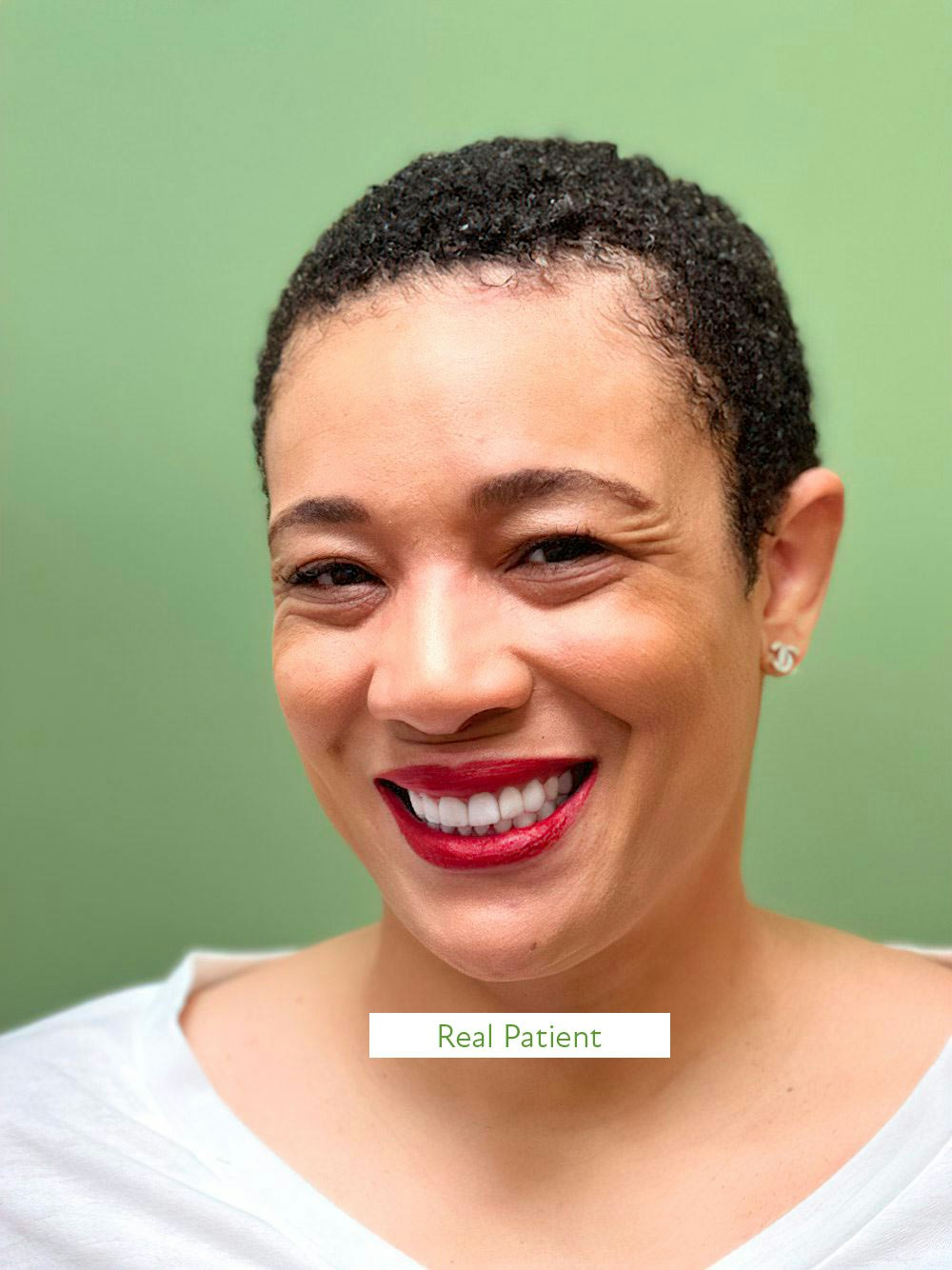 Actual patient smiling