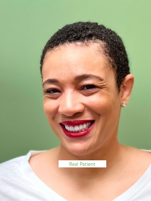 man wearing invisalign