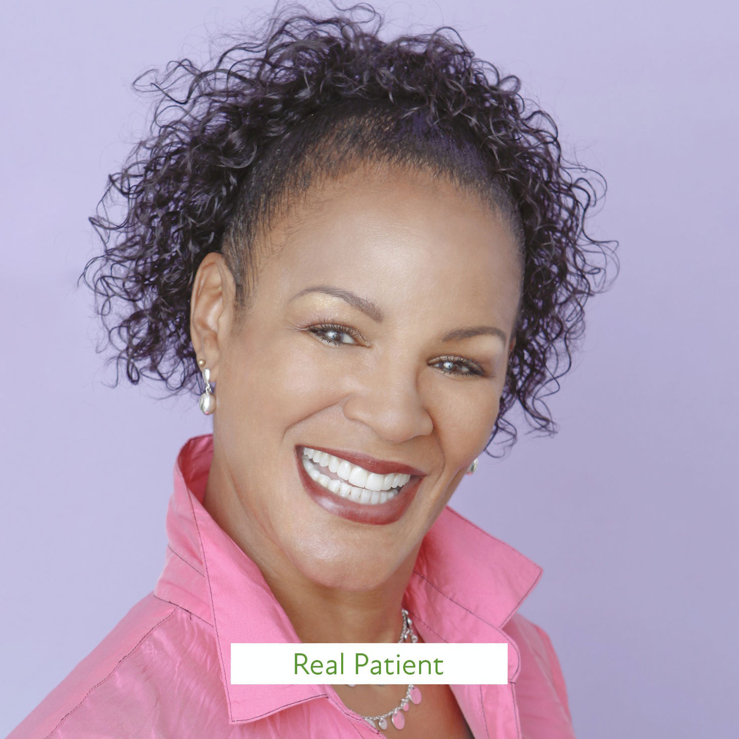 Marlene (real patient) after she received teeth whitening