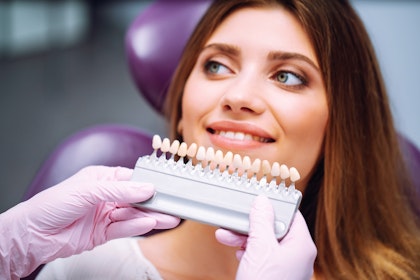 Dentist color-matching veneers to a patient's smile