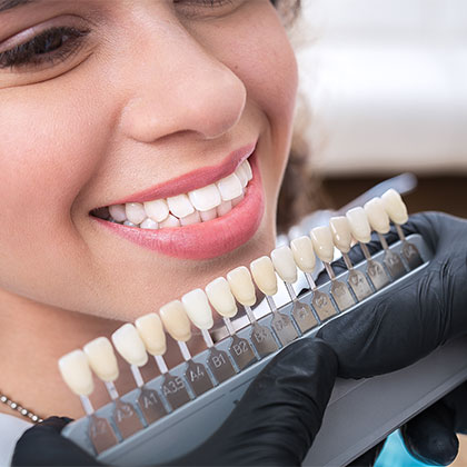 Person being shade matched for veneers