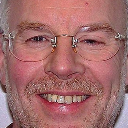 Dr. N. Summer Lerch's Patient Before Dental Crowns