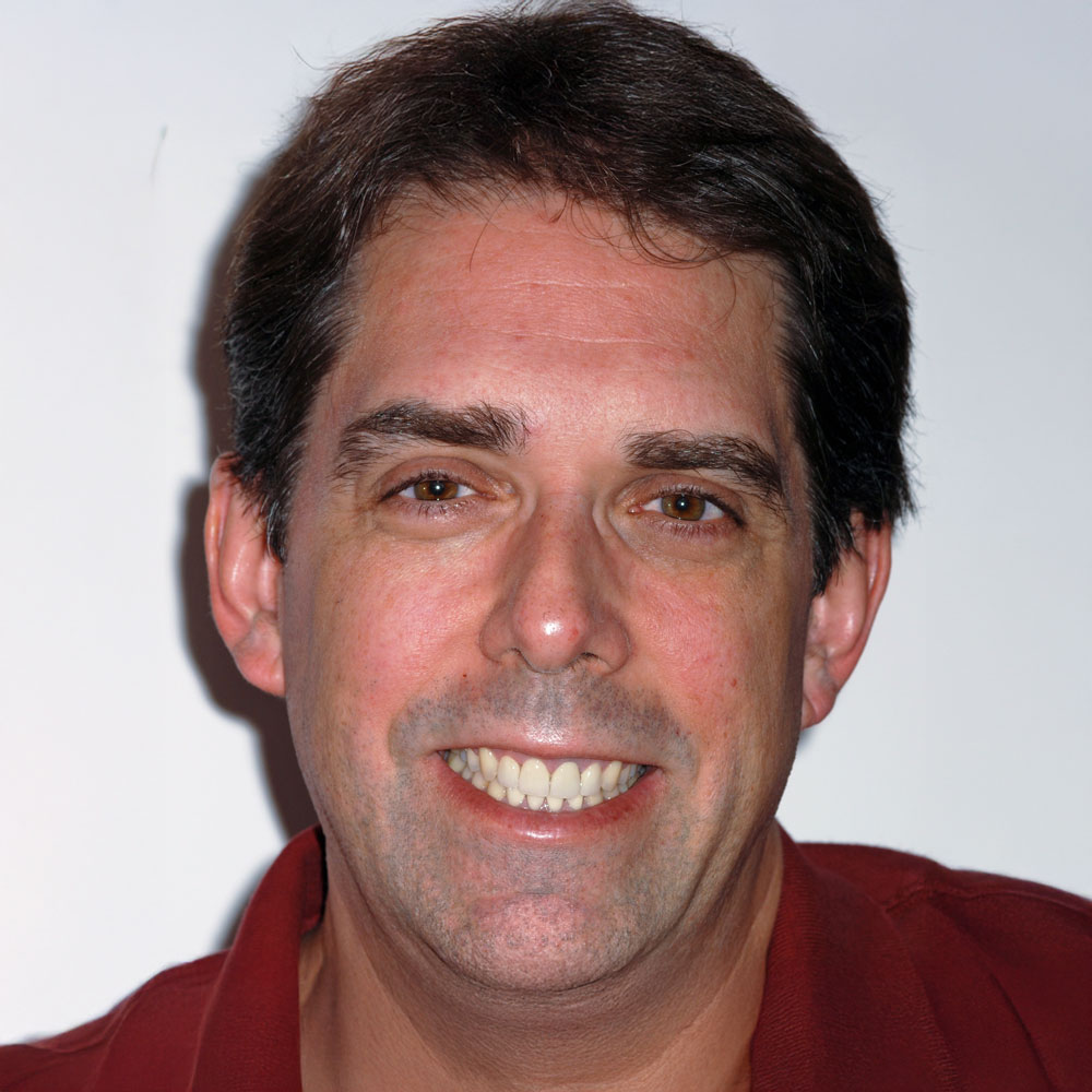 Patient with a bright, even smile after smile makeover treatment