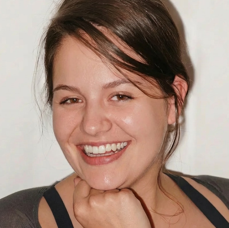 Smiling woman resting her chin on her hand, showing even, white teeth after cosmetic dental treatment