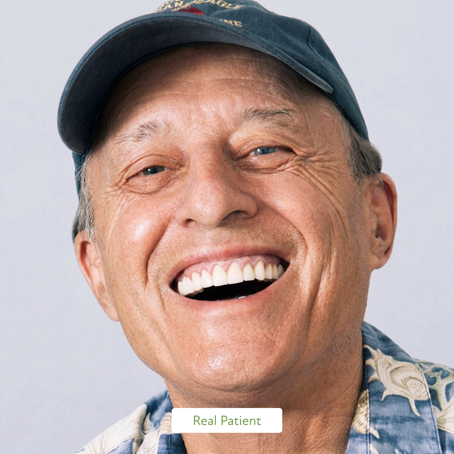 Close-up of a porcelain dental crown