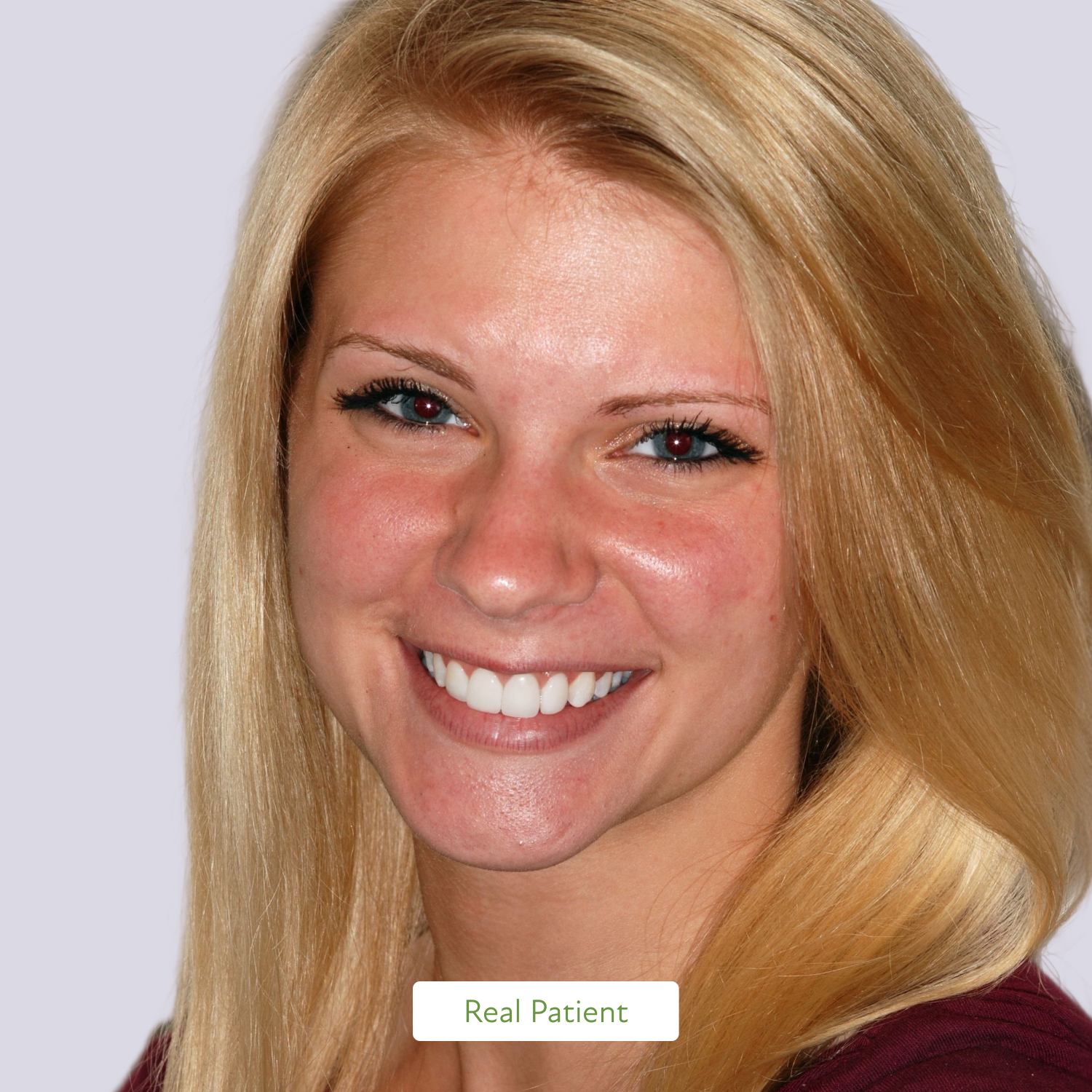 Dental laser being used during gum disease treatment