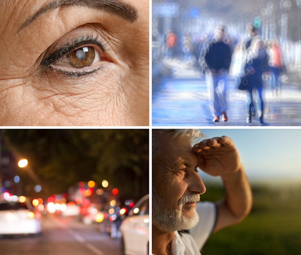 visual representation of symptoms of cataract