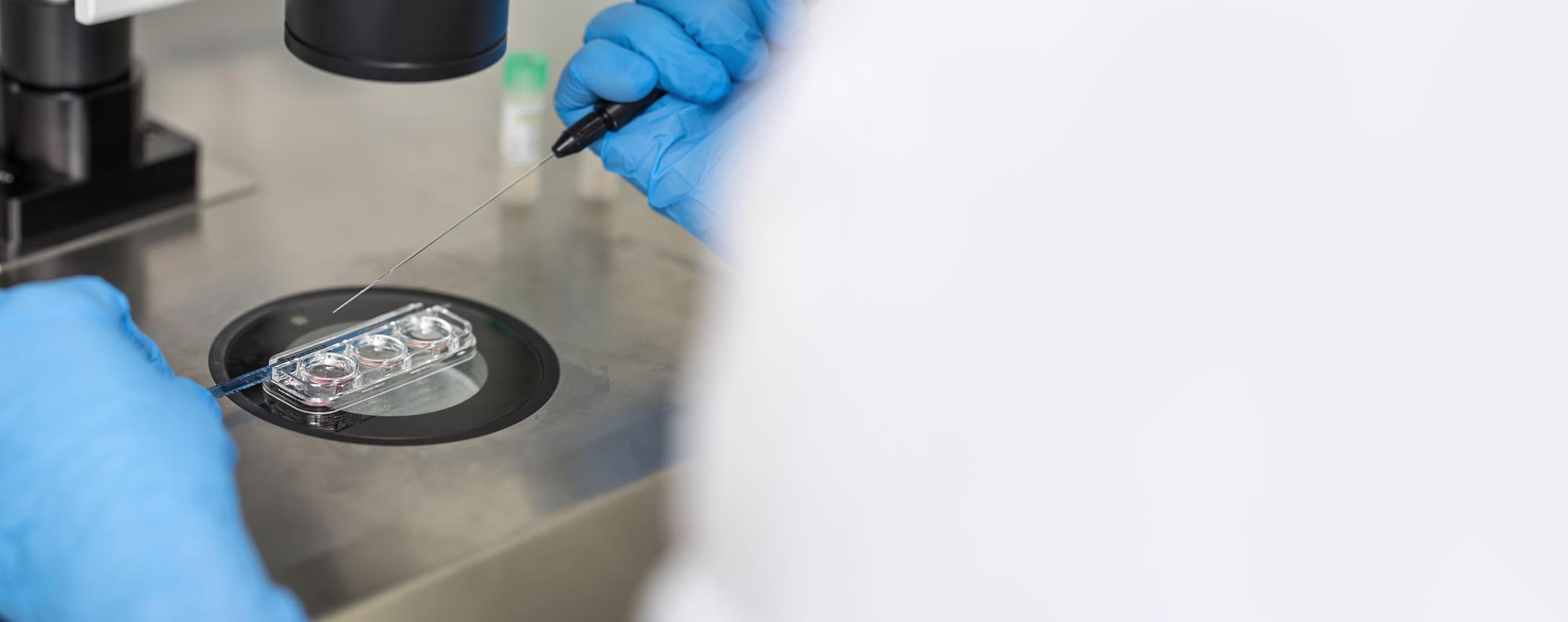 Intracytoplasmic Sperm Injection