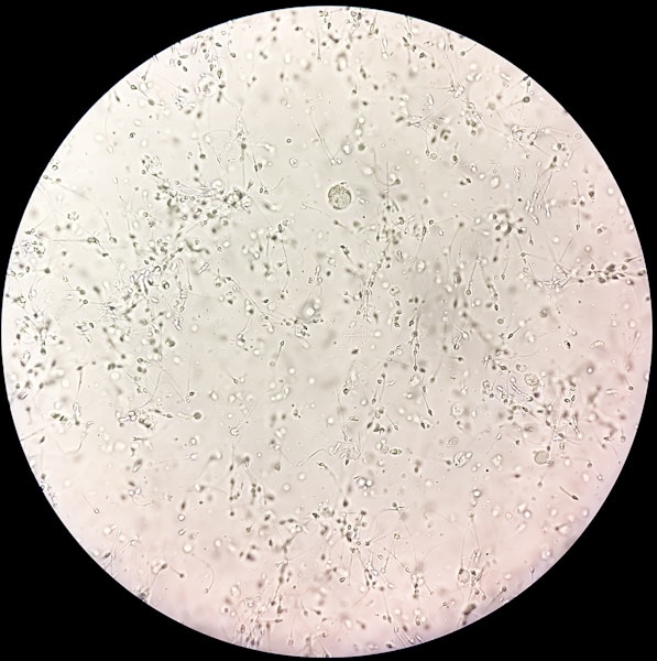 Sperm morphology under a microscope