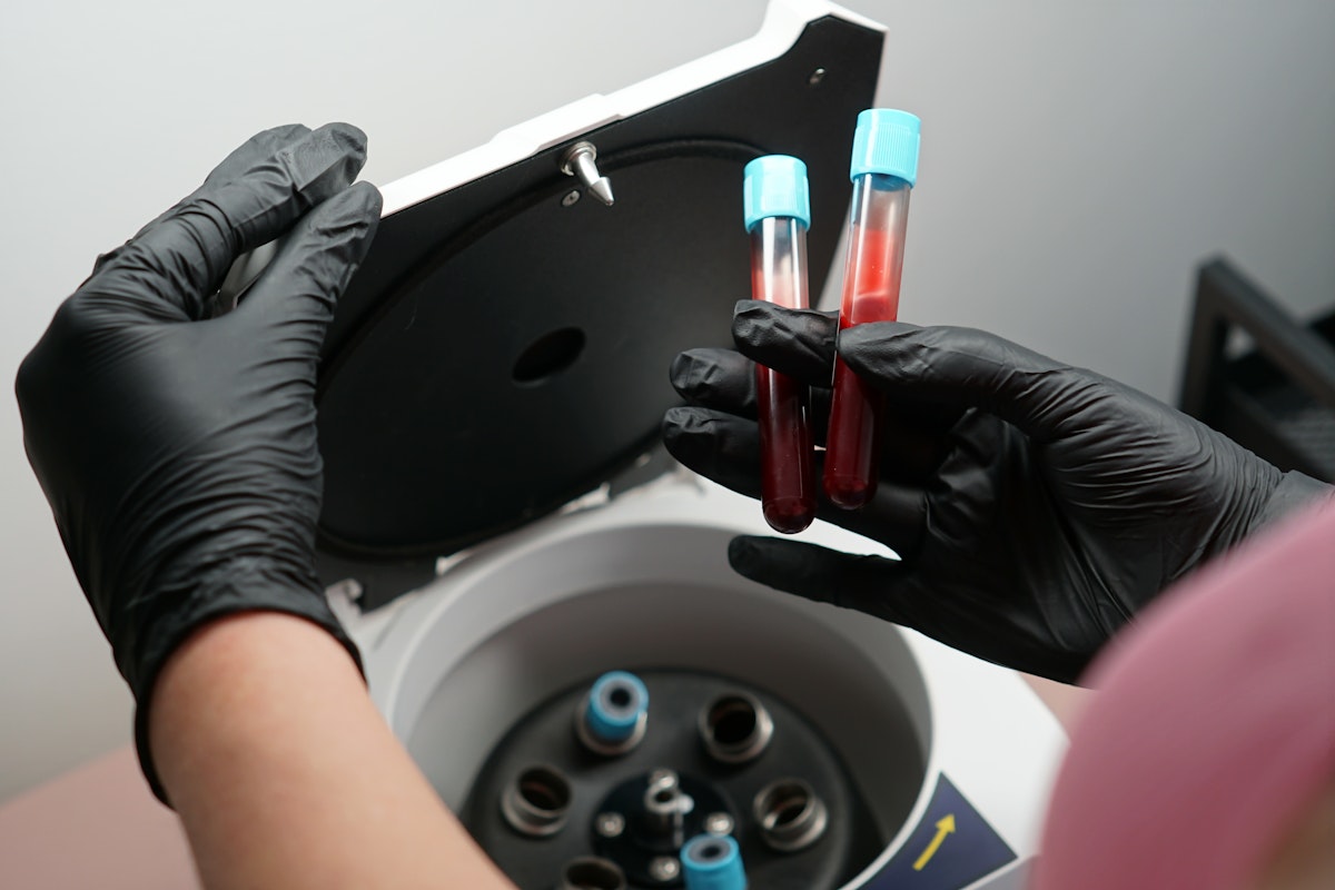 Technician removing PRP test tubes from a machine