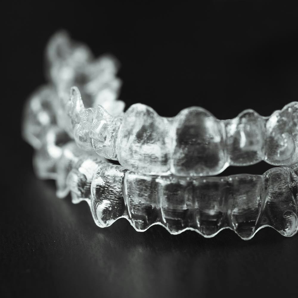 Invisalign aligner